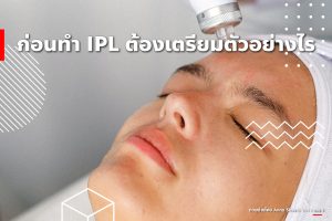 สิ่งหน้าลอก IPL ใสก้นเป็นสิวทํารอยที่หลังดดำต่างๆจบ 6 สิ่ง? 2 ก่อนทำ IPL ต้องเตรียมตัวอย่างไร